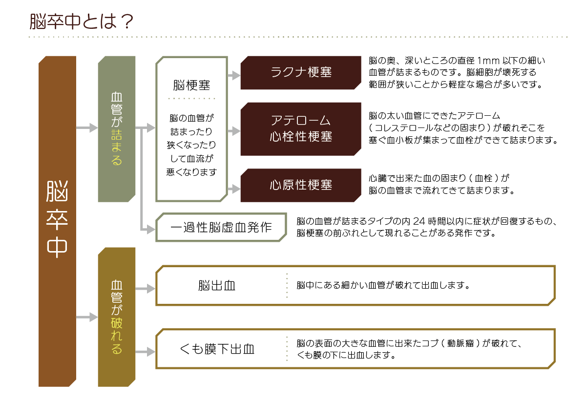脳卒中とは