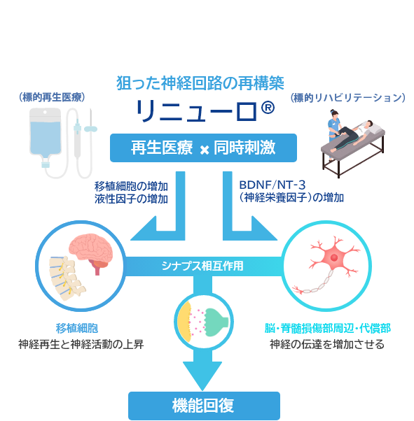 リニューロ治療のインフォグラフィック—再生医療と同時刺激で神経伝達を強化し、機能回復を目指す図。